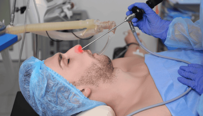 Endoscopic Sinus Surgery