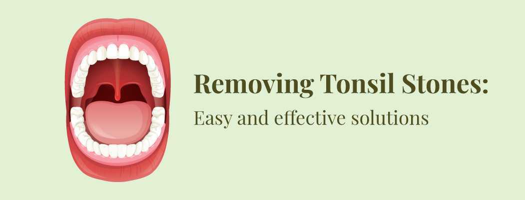 Home remedies for How To Get Rid Of Tonsil Stones